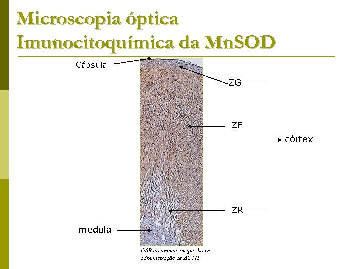 Microscopia óptica Imunocitoquímica da Mn. SOD Cápsula ZG ZF córtex ZR medula GSR do