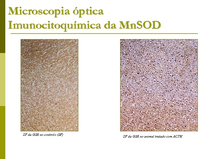 Microscopia óptica Imunocitoquímica da Mn. SOD ZF da GSR no controlo (SF) ZF da