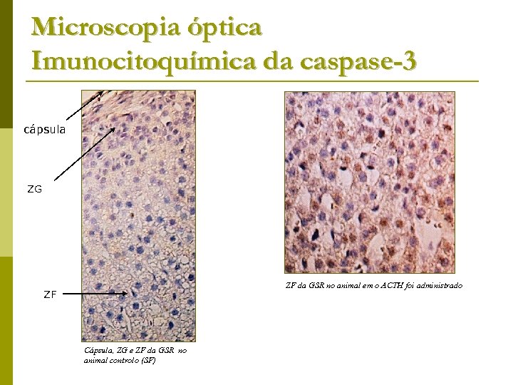 Microscopia óptica Imunocitoquímica da caspase-3 cápsula ZG ZF da GSR no animal em o