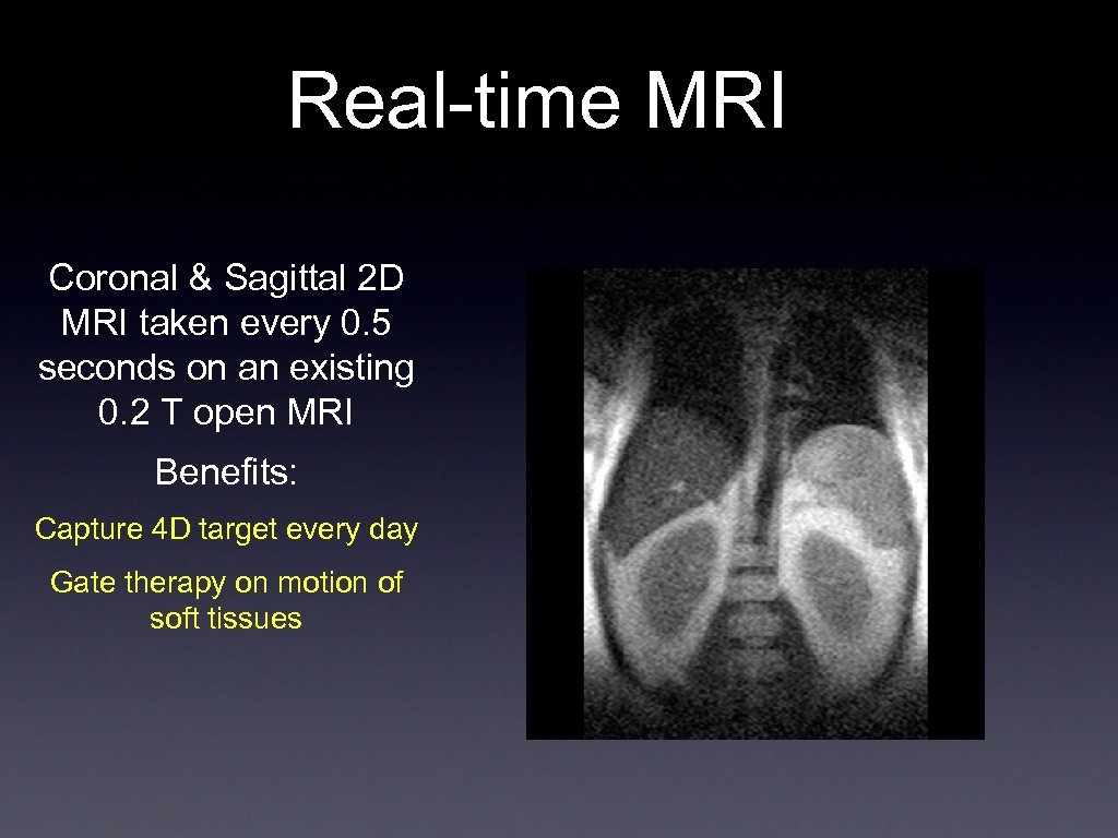 Real-time MRI Coronal & Sagittal 2 D MRI taken every 0. 5 seconds on