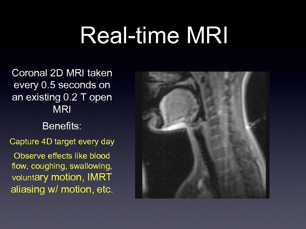 Real-time MRI Coronal 2 D MRI taken every 0. 5 seconds on an existing