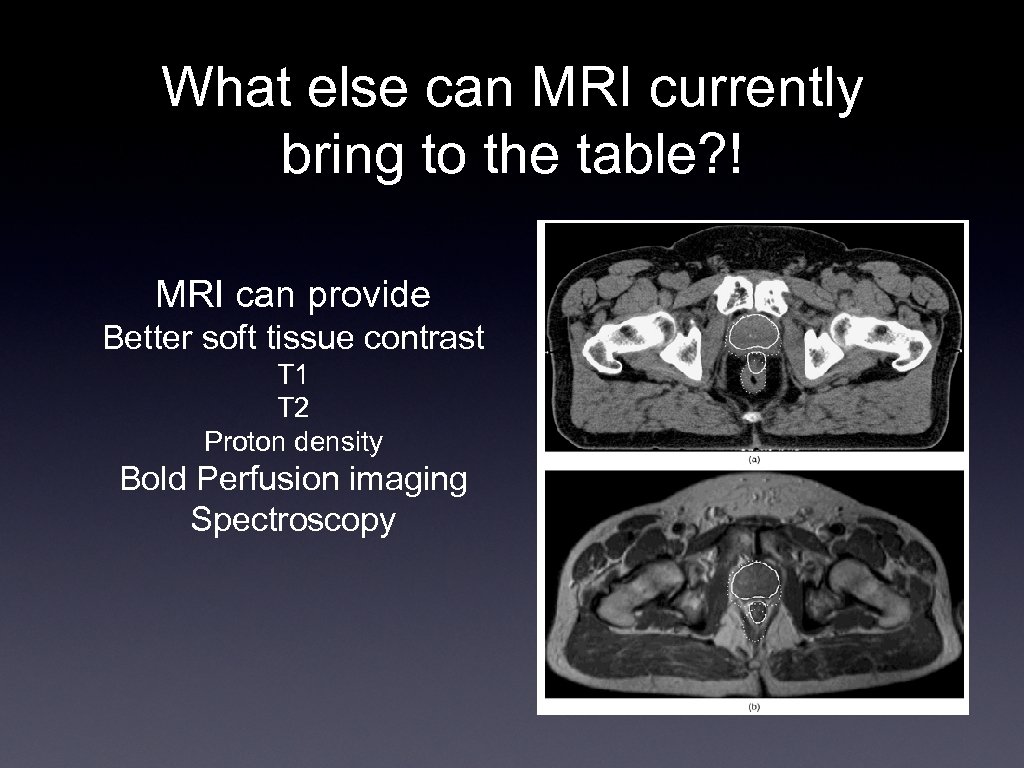 What else can MRI currently bring to the table? ! MRI can provide Better