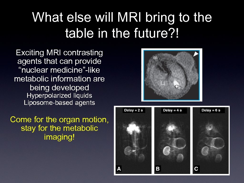 What else will MRI bring to the table in the future? ! Exciting MRI