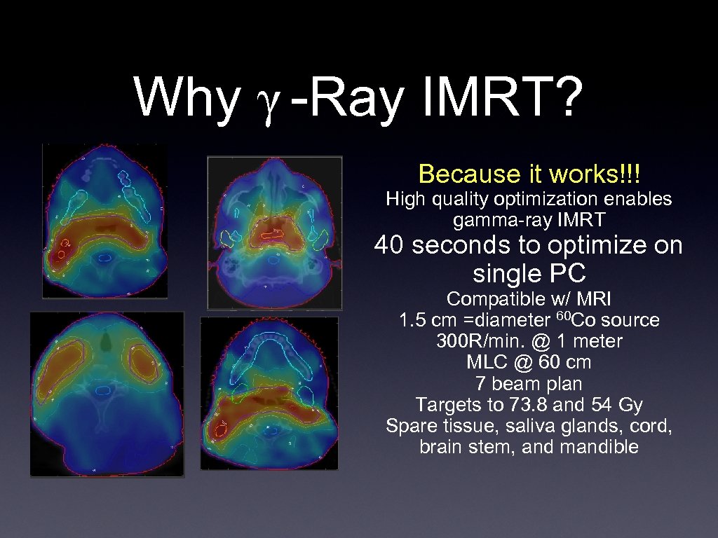 Why γ -Ray IMRT? Because it works!!! High quality optimization enables gamma-ray IMRT 40