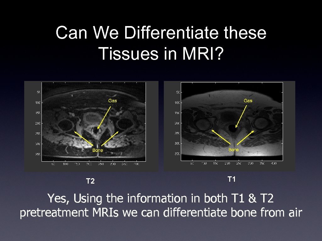 Can We Differentiate these Tissues in MRI? T 2 T 1 Yes, Using the