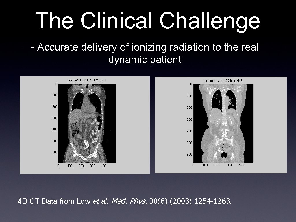 The Clinical Challenge - Accurate delivery of ionizing radiation to the real dynamic patient