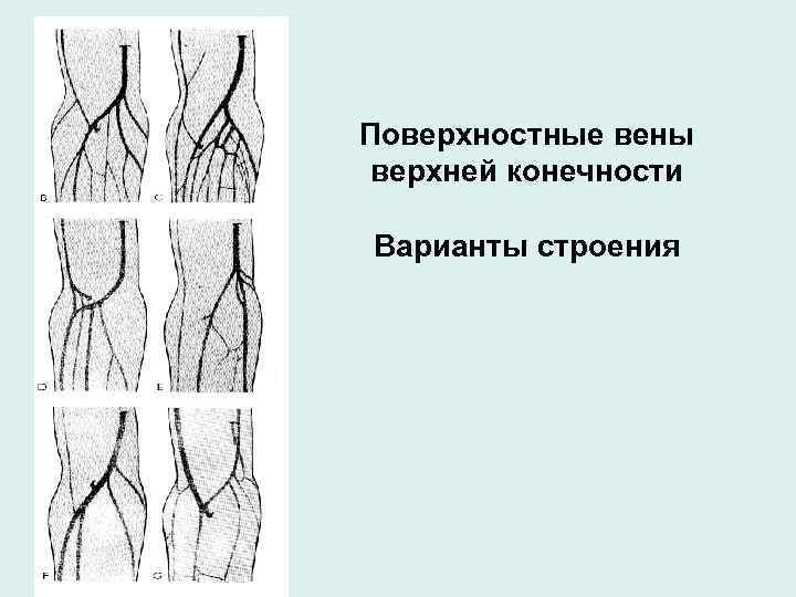 Вены строение картинка