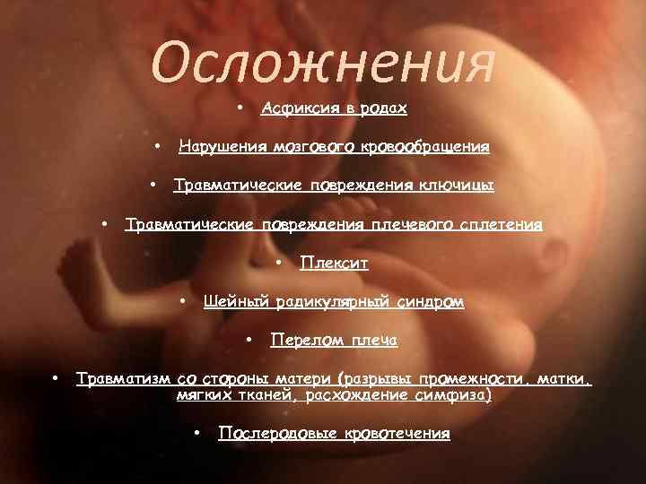 Дистоция плечиков презентация