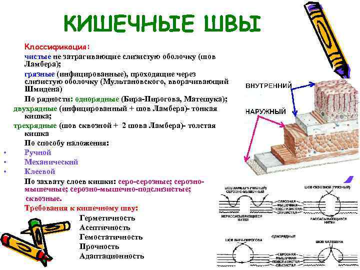 КИШЕЧНЫЕ ШВЫ Классификация: чистые не затрагивающие слизистую оболочку (шов Ламбера); грязные (инфицированные), проходящие через