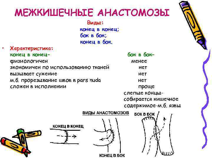 МЕЖКИШЕЧНЫЕ АНАСТОМОЗЫ • Виды: конец в конец; бок в бок; конец в бок. Характеристика: