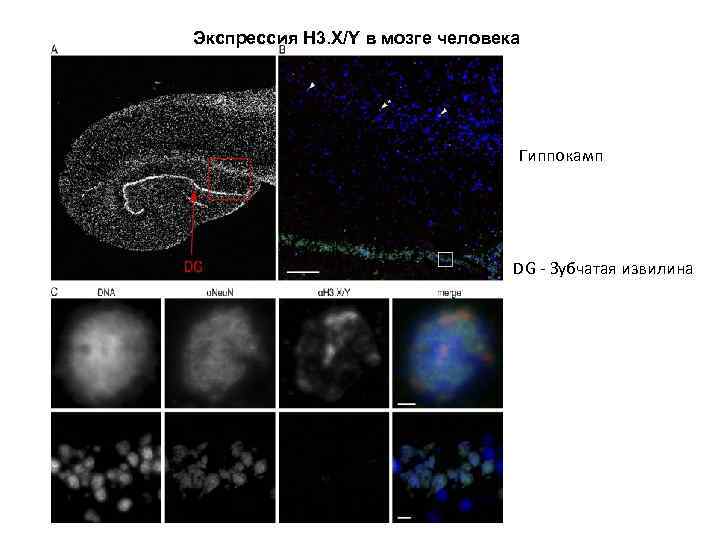 Экспрессия H 3. X/Y в мозге человека Гиппокамп DG - Зубчатая извилина 