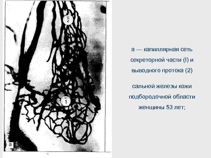 а — капиллярная сеть секреторной части (I) и выводного протока (2) сальной железы кожи