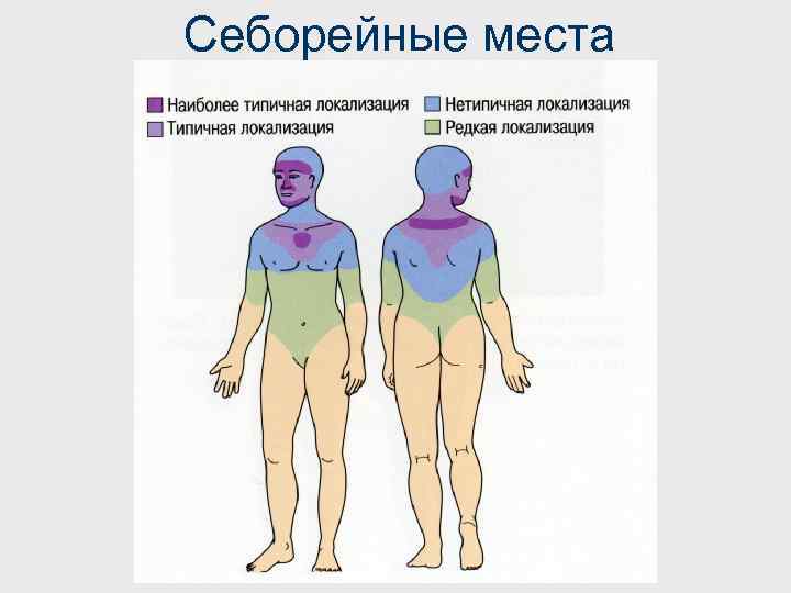 Себорейные места 