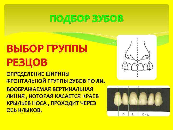 ПОДБОР ЗУБОВ ВЫБОР ГРУППЫ РЕЗЦОВ ОПРЕДЕЛЕНИЕ ШИРИНЫ ФРОНТАЛЬНОЙ ГРУППЫ ЗУБОВ ПО ЛИ. ВООБРАЖАЕМАЯ ВЕРТИКАЛЬНАЯ