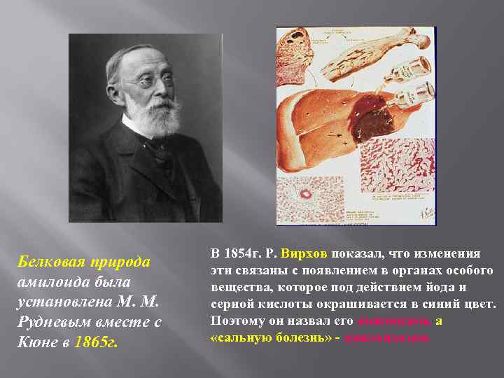 Белковая природа амилоида была установлена М. М. Рудневым вместе с Кюне в 1865 г.