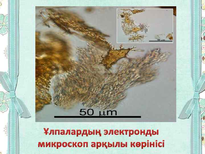 Ұлпалардың электронды микроскоп арқылы көрінісі 