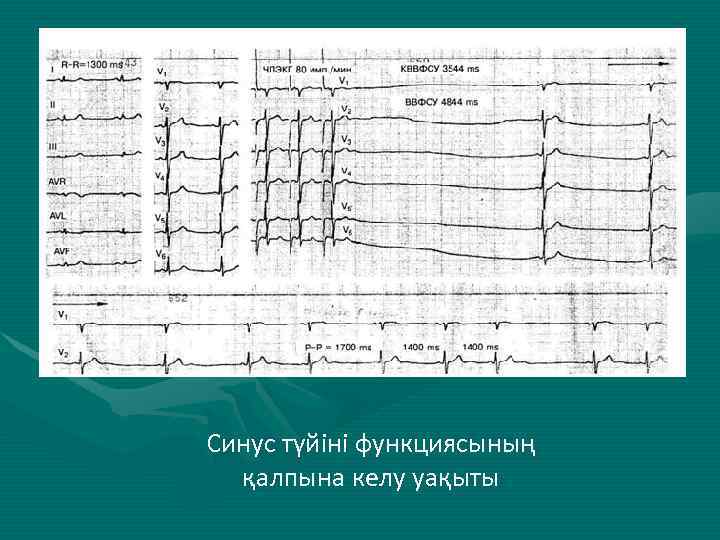 Синус түйіні функциясының қалпына келу уақыты 