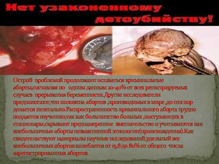Острой проблемой продолжают оставаться криминальные аборты, составляя по одним данным 20 -40% от всех