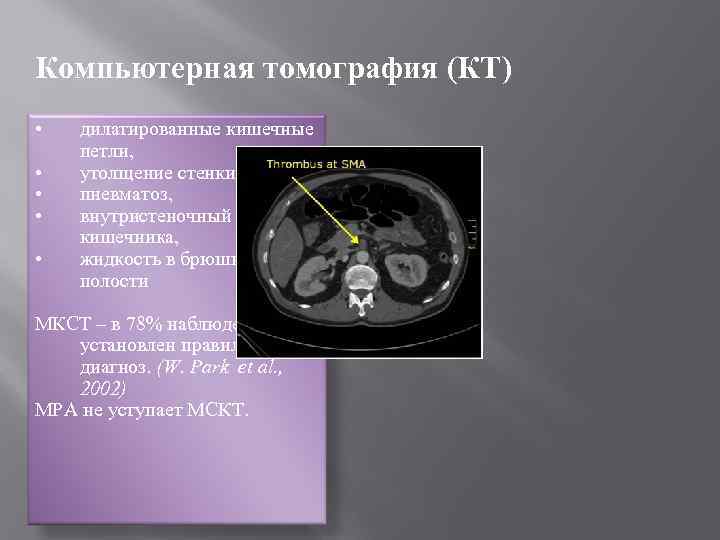 Компьютерная томография (КТ) • • • дилатированные кишечные петли, утолщение стенки кишки, пневматоз, внутристеночный