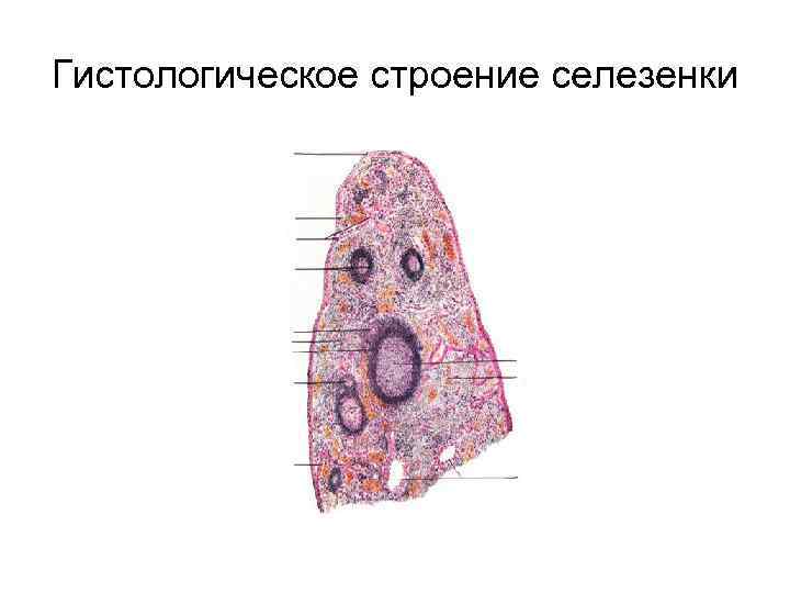 Селезенка гистология рисунок с подписями