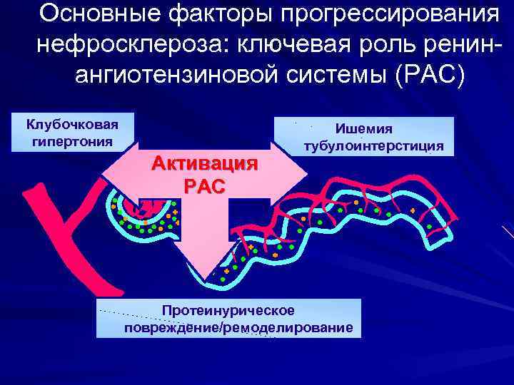 Основные факторы прогрессирования нефросклероза: ключевая роль ренинангиотензиновой системы (РАС) Клубочковая гипертония Активация РАС Ишемия