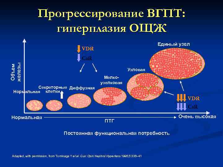 Прогрессирование ВГПТ: гиперплазия ОЩЖ Единый узел VDR Объем железы Ca. R Узловая Секреторные Диффузная
