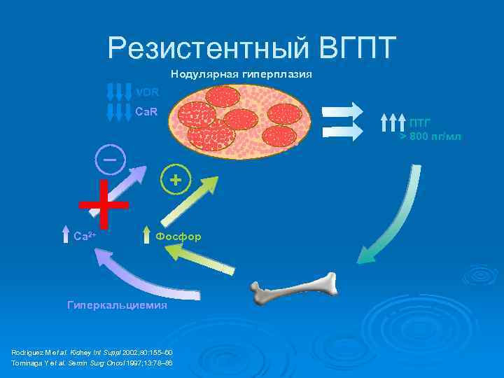 Резистентный ВГПТ Нодулярная гиперплазия VDR Ca. R – Ca 2+ ПТГ > 800 пг/мл