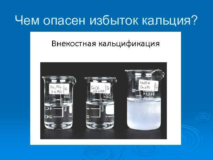 Чем опасен избыток кальция? 