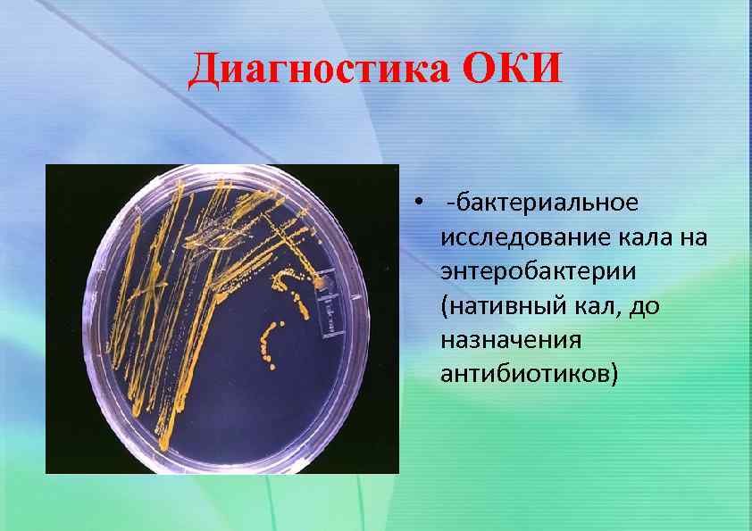 Диагностика ОКИ • -бактериальное исследование кала на энтеробактерии (нативный кал, до назначения антибиотиков) 