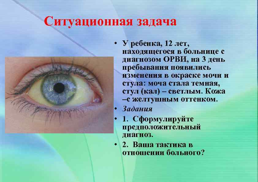Ситуационная задача • У ребенка, 12 лет, находящегося в больнице с диагнозом ОРВИ, на
