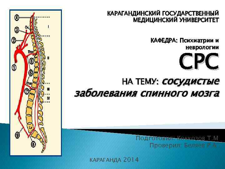 КАРАГАНДИНСКИЙ ГОСУДАРСТВЕННЫЙ МЕДИЦИНСКИЙ УНИВЕРСИТЕТ КАФЕДРА: Психиатрии и неврологии СРС НА ТЕМУ: сосудистые заболевания спинного