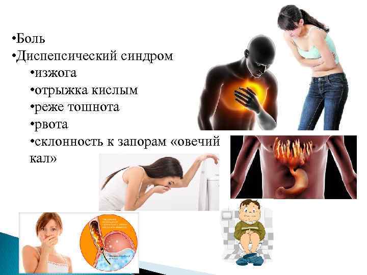  • Боль • Диспепсический синдром • изжога • отрыжка кислым • реже тошнота