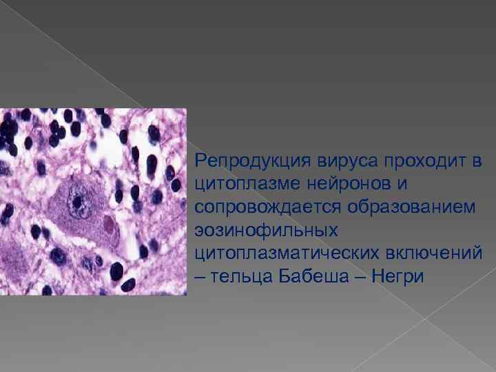 Репродукция вируса проходит в цитоплазме нейронов и сопровождается образованием эозинофильных цитоплазматических включений – тельца