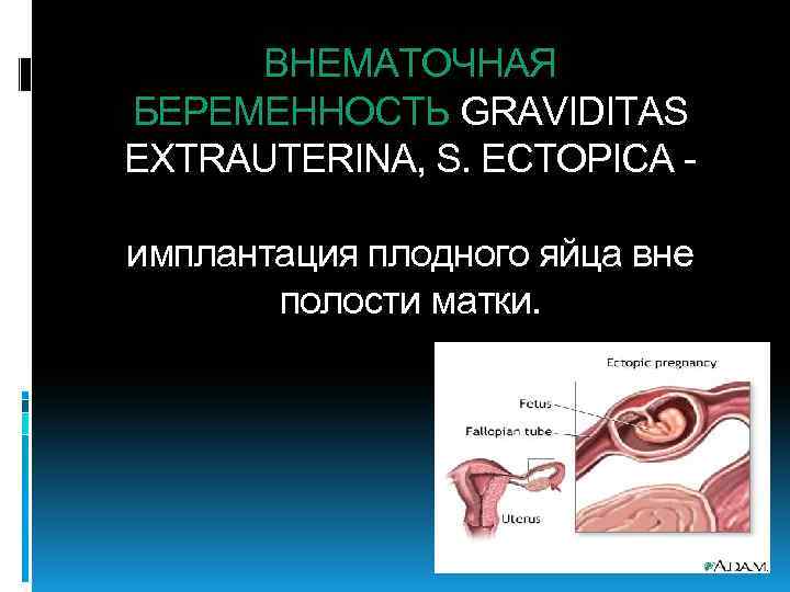 ВНЕМАТОЧНАЯ БЕРЕМЕННОСТЬ GRAVIDITAS EXTRAUTERINA, S. ECTOPICA имплантация плодного яйца вне полости матки. 