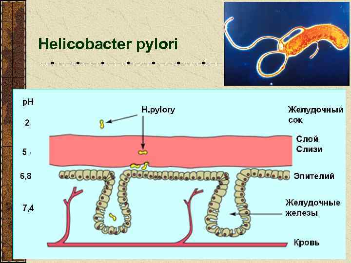 Helicobacter pylori 