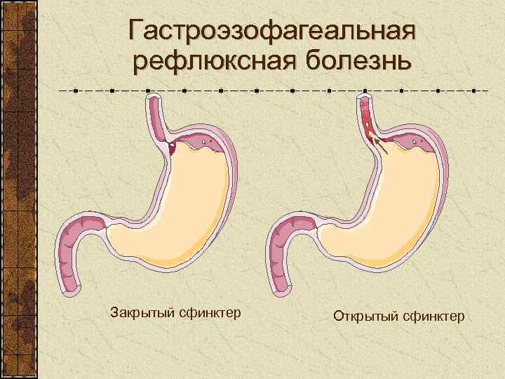 Закрытие сфинктера. Сфинктеры пищеварительной системы. Сфинктеры пищеварительной трубки. Механизм открытия пилорического сфинктера.