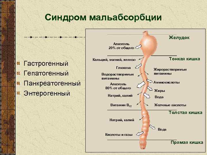 Синдром мальабсорбции Желудок Алкоголь 20% от общего Гастрогенный Гепатогенный Панкреатогенный Энтерогенный Тонкая кишка Кальций,