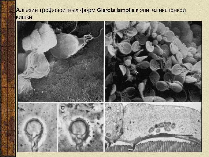 Адгезия трофозоитных форм Giardia lamblia к эпителию тонкой кишки 