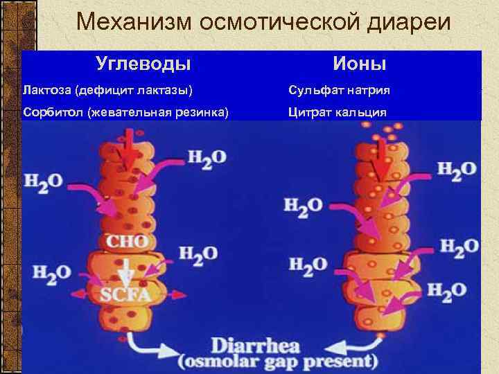 Механизм осмотической диареи Углеводы Ионы Лактоза (дефицит лактазы) Сульфат натрия Сорбитол (жевательная резинка) Цитрат