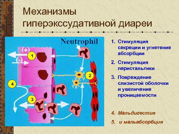 Механизмы гиперэкссудативной диареи 1. Стимуляция секреции и угнетение абсорбции 1 2. Стимуляция перистальтики 2