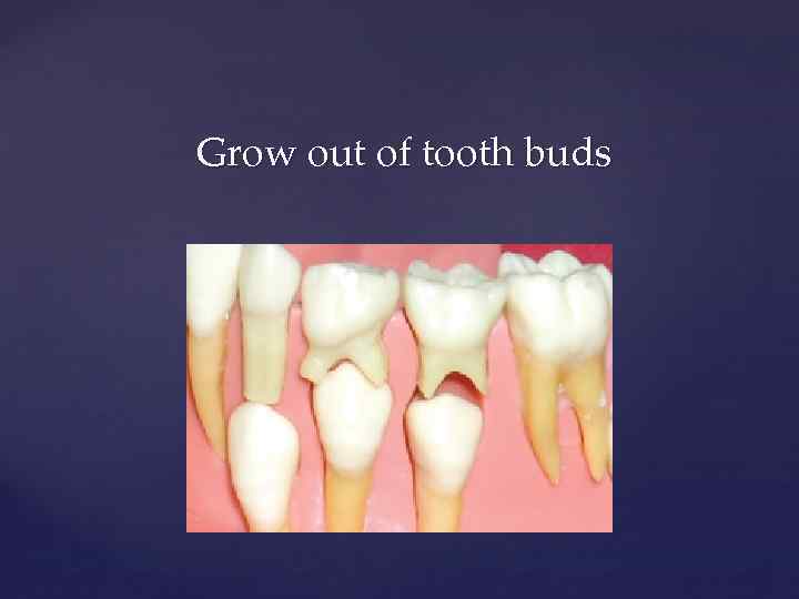 Grow out of tooth buds 