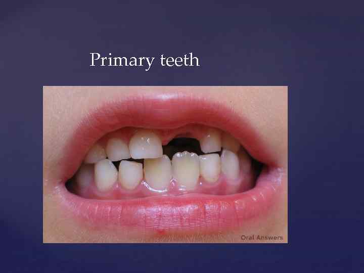 Primary teeth 