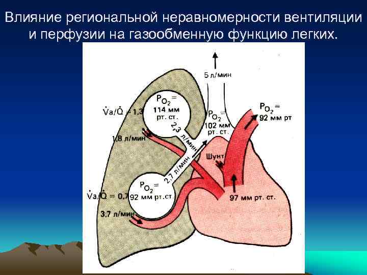 Влияние региональной неравномерности вентиляции и перфузии на газообменную функцию легких. 
