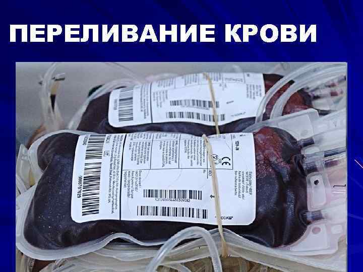 ПЕРЕЛИВАНИЕ КРОВИ 
