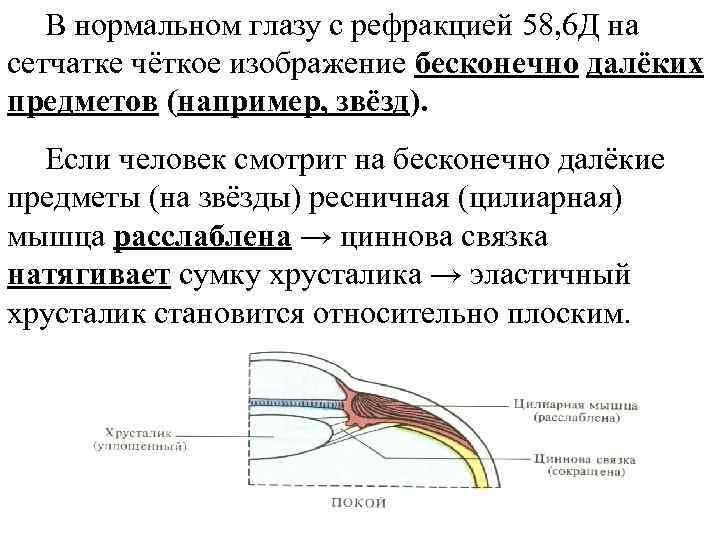 В нормальном глазу с рефракцией 58, 6 Д на сетчатке чёткое изображение бесконечно далёких