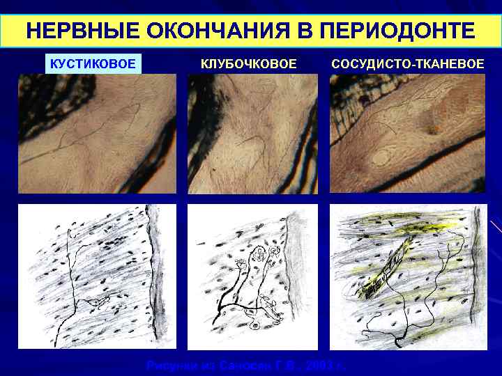 НЕРВНЫЕ ОКОНЧАНИЯ В ПЕРИОДОНТЕ КУСТИКОВОЕ КЛУБОЧКОВОЕ СОСУДИСТО-ТКАНЕВОЕ Рисунки из Саносян Г. В. , 2003