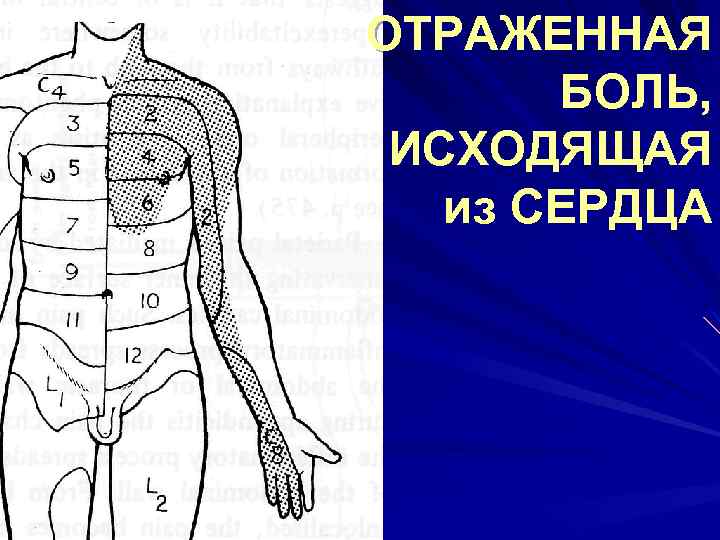 ОТРАЖЕННАЯ БОЛЬ, ИСХОДЯЩАЯ из СЕРДЦА 