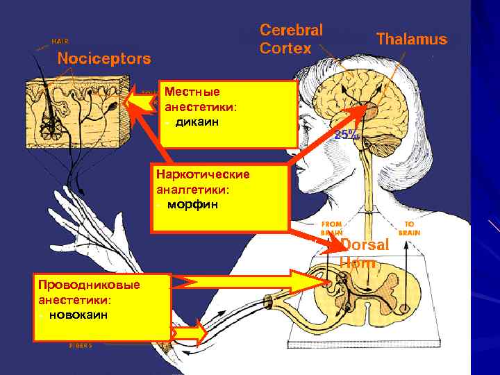 Местные анестетики: - дикаин 5% 25% Наркотические аналгетики: - морфин 75% Проводниковые анестетики: -