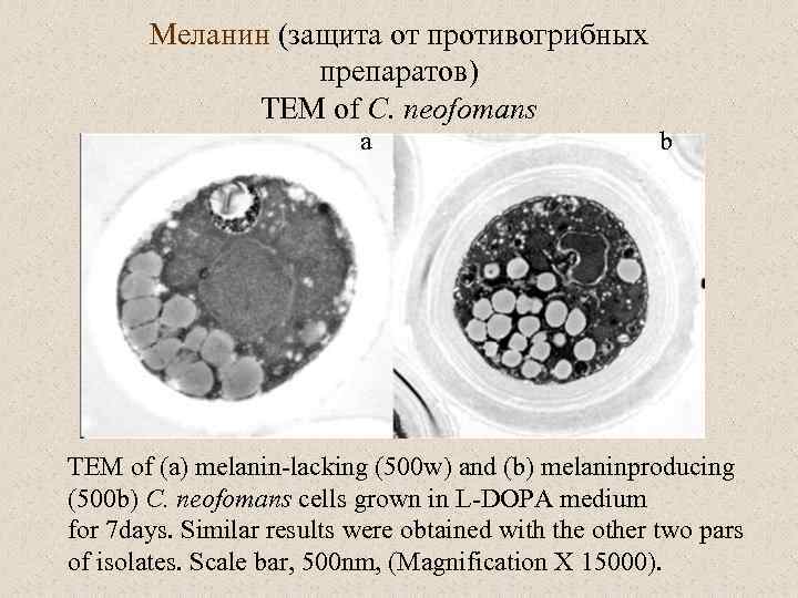 Меланин (защита от противогрибных препаратов) TEM of C. neofomans a b TEM of (a)