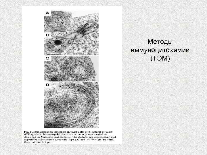 Методы иммуноцитохимии (ТЭМ) 